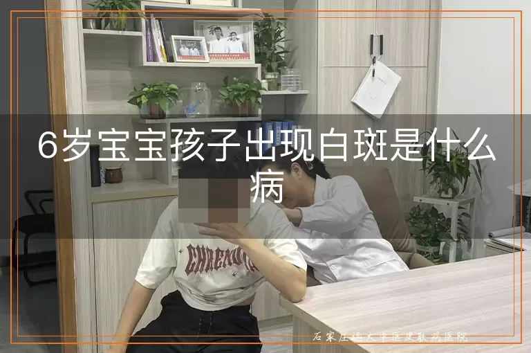 6岁宝宝孩子出现白斑是什么病