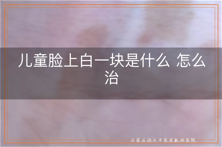 儿童脸上白一块是什么 怎么治