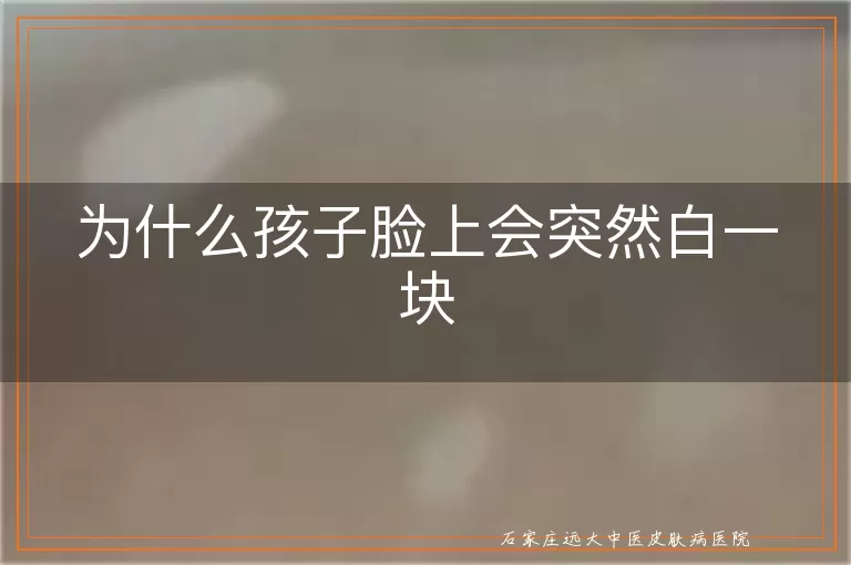 为什么孩子脸上会突然白一块