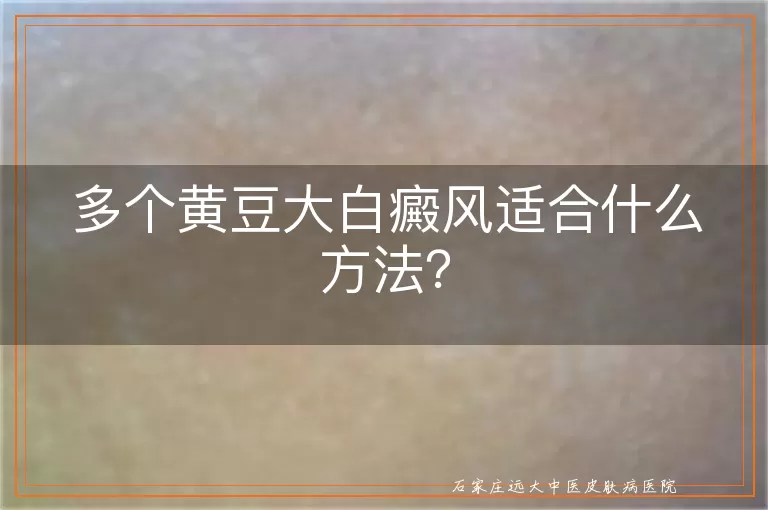 多个黄豆大白癜风适合什么方法？
