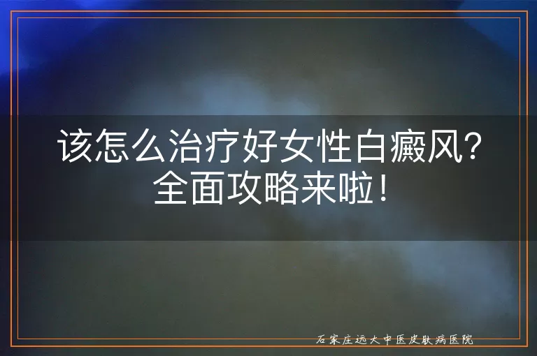 该怎么治疗好女性白癜风？全面攻略来啦！