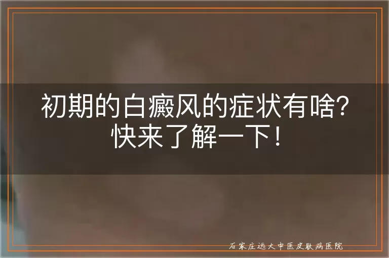 初期的白癜风的症状有啥？快来了解一下！