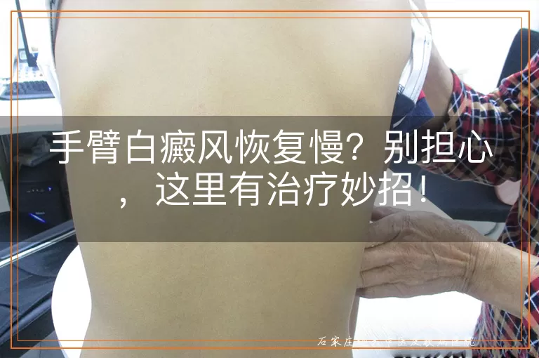 手臂白癜风恢复慢？别担心，这里有治疗妙招！