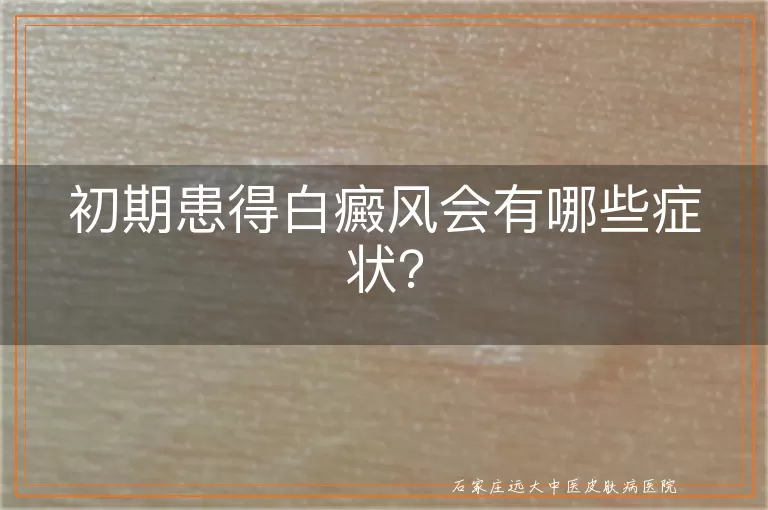 初期患得白癜风会有哪些症状？