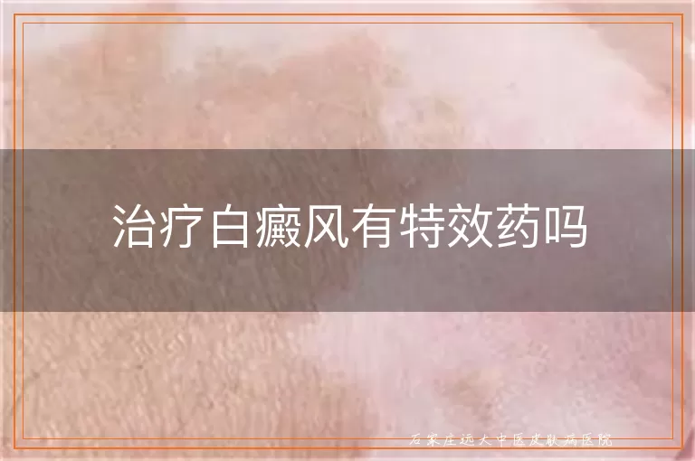 治疗白癜风有特效药吗