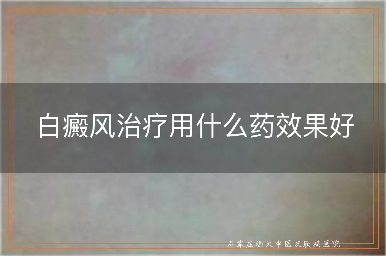 白癜风治疗用什么药效果好