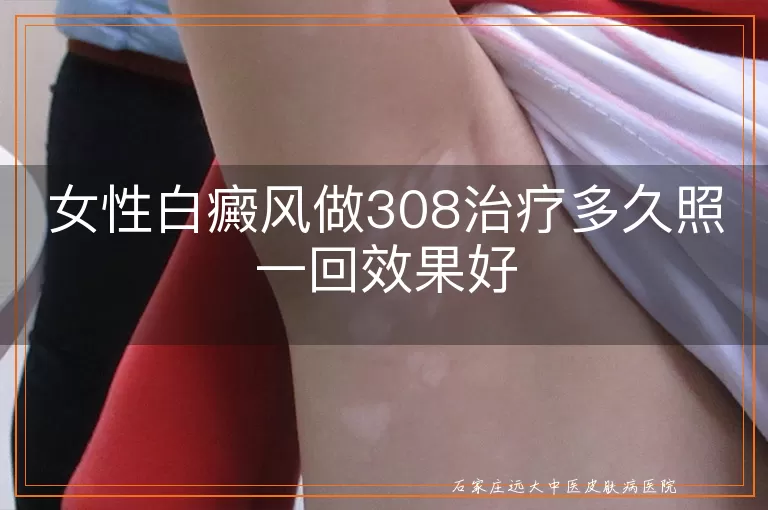 女性白癜风做308治疗多久照一回效果好