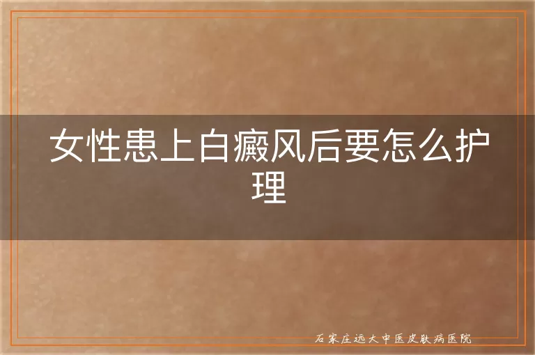 女性患上白癜风后要怎么护理