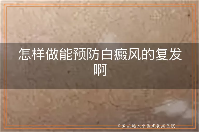 怎样做能预防白癜风的复发啊