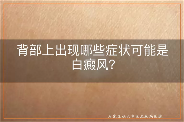 背部上出现哪些症状可能是白癜风？