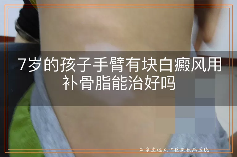 7岁的孩子手臂有块白癜风用补骨脂能治好吗