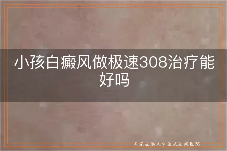 小孩白癜风做极速308治疗能好吗