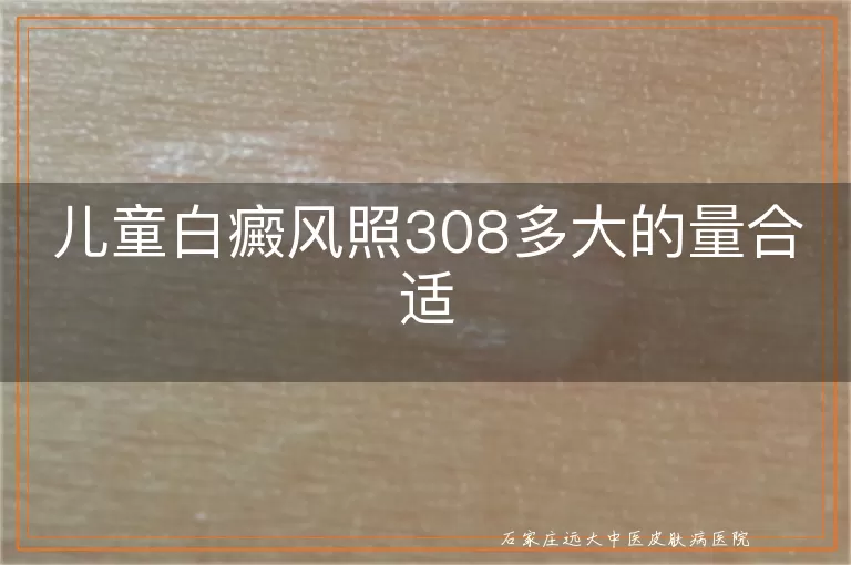 儿童白癜风照308多大的量合适