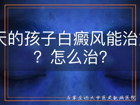 60天的孩子白癜风能治好吗?怎么治?
