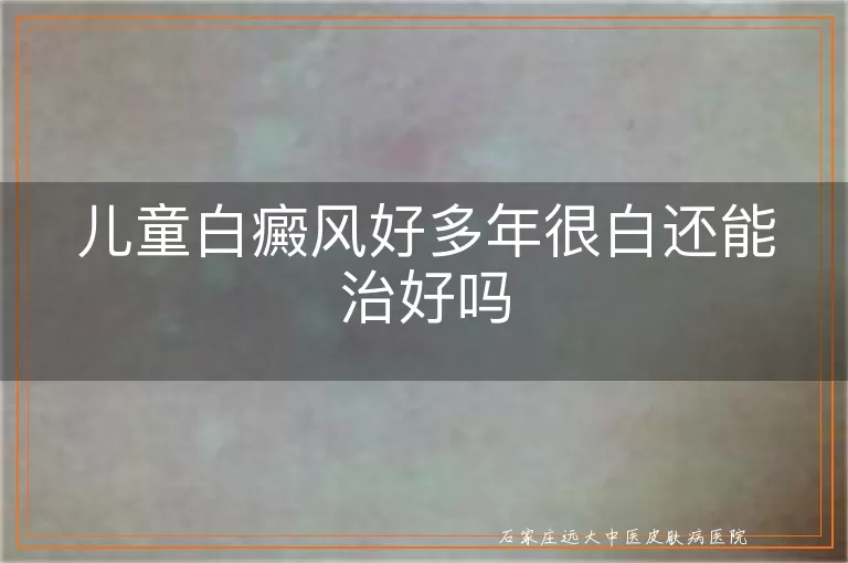 儿童白癜风好多年很白还能治好吗