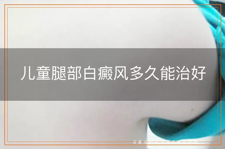 儿童腿部白癜风多久能治好