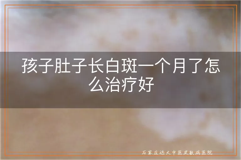 孩子肚子长白斑一个月了怎么治疗好