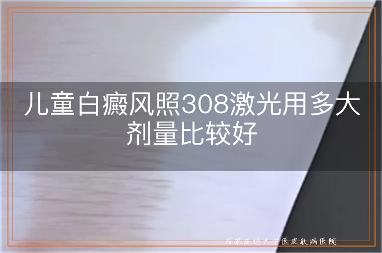 儿童白癜风照308激光用多大剂量比较好
