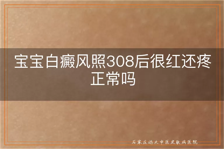 宝宝白癜风照308后很红还疼正常吗
