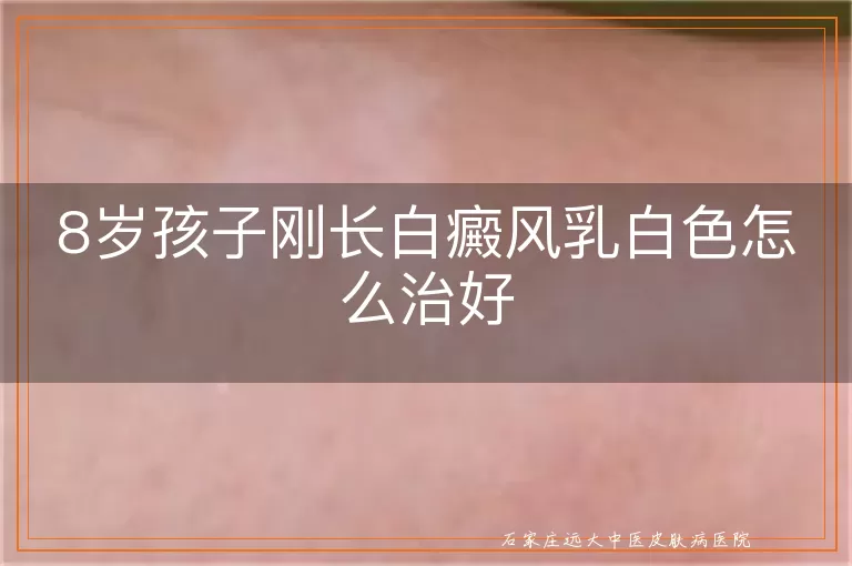 8岁孩子刚长白癜风乳白色怎么治好