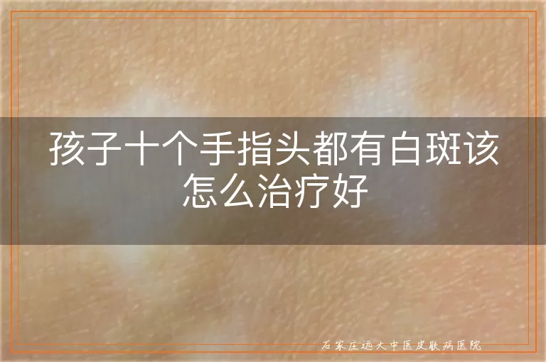 孩子十个手指头都有白斑该怎么治疗好