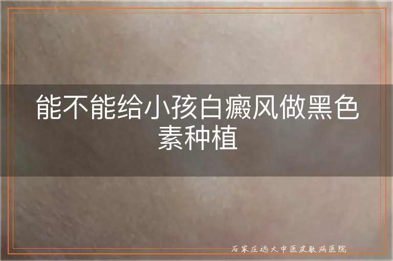 能不能给小孩白癜风做黑色素种植