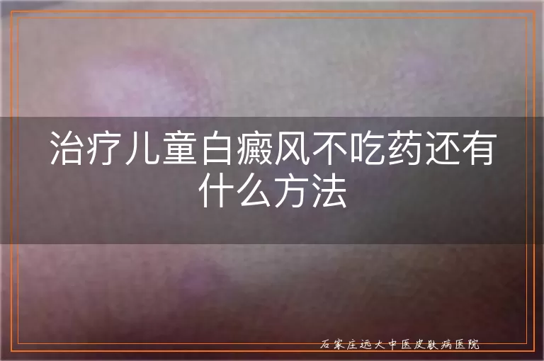 治疗儿童白癜风不吃药还有什么方法