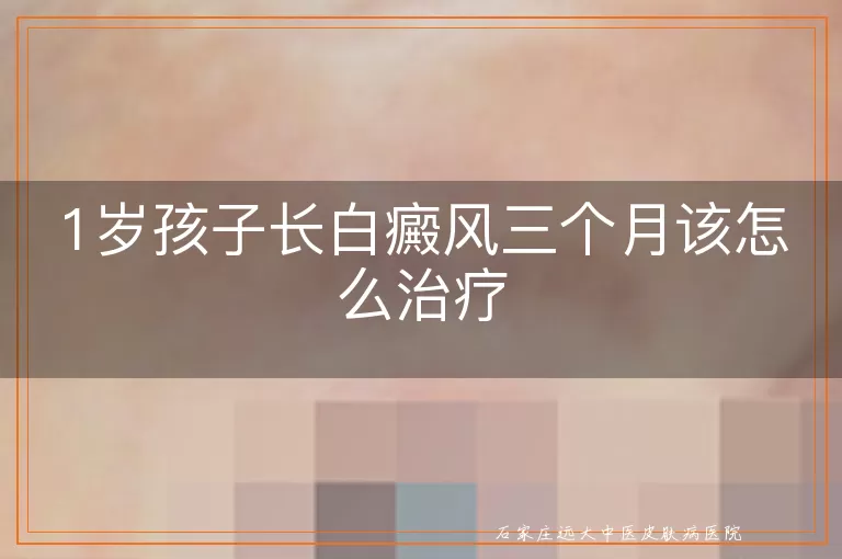 1岁孩子长白癜风三个月该怎么治疗