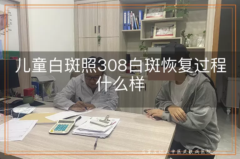 儿童白斑照308白斑恢复过程什么样