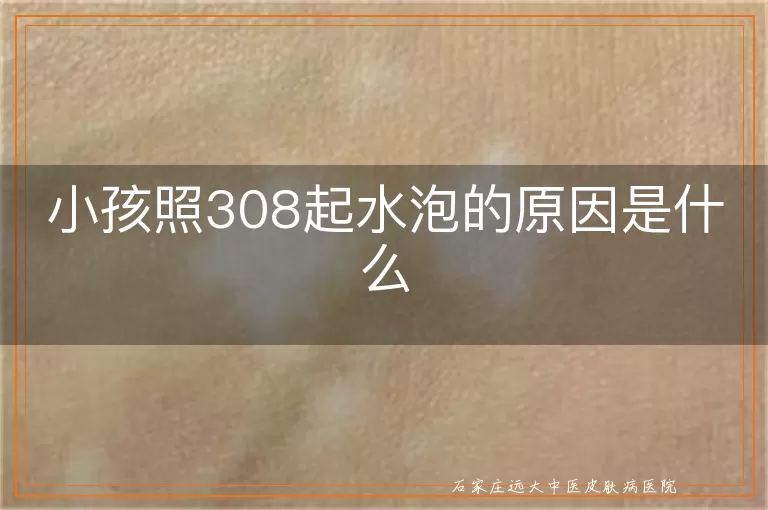 小孩照308起水泡的原因是什么