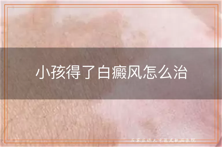 小孩得了白癜风怎么治