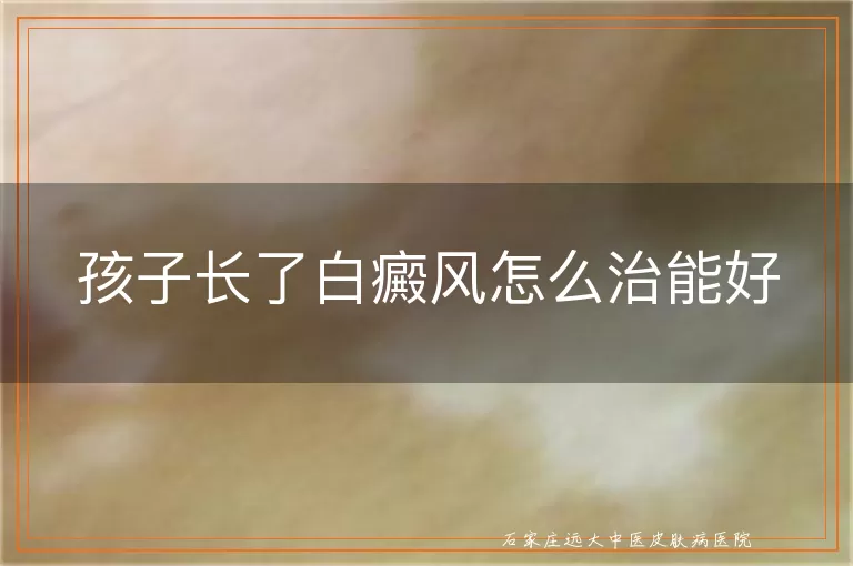 孩子长了白癜风怎么治能好