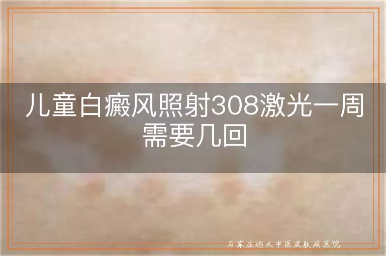 儿童白癜风照射308激光一周需要几回