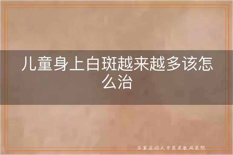 儿童身上白斑越来越多该怎么治