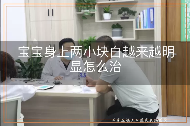 宝宝身上两小块白越来越明显怎么治