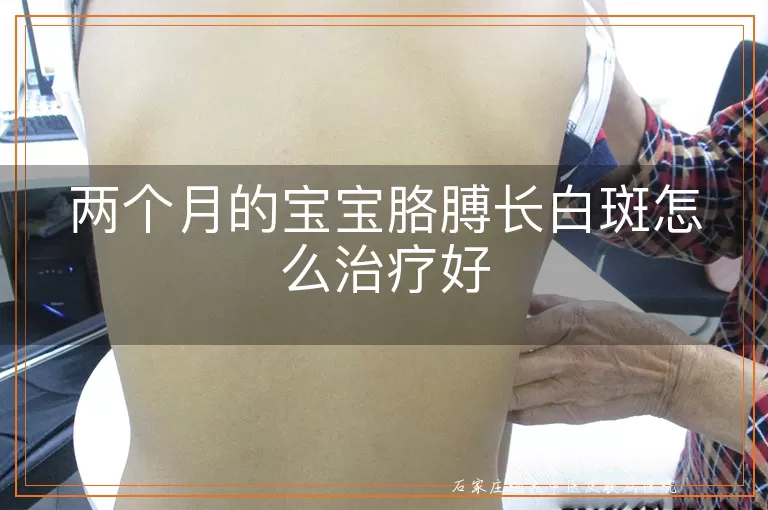 两个月的宝宝胳膊长白斑怎么治疗好