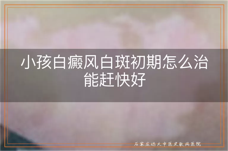 小孩白癜风白斑初期怎么治能赶快好
