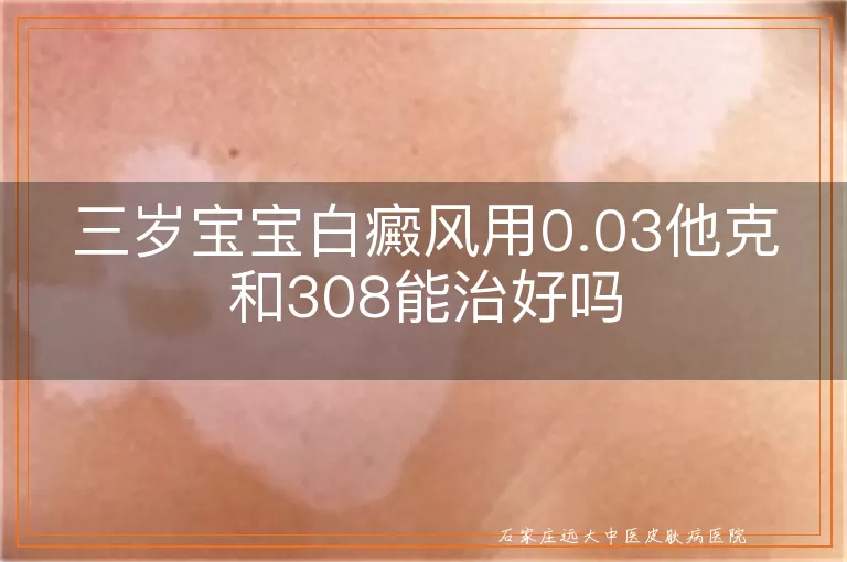 三岁宝宝白癜风用0.03他克和308能治好吗