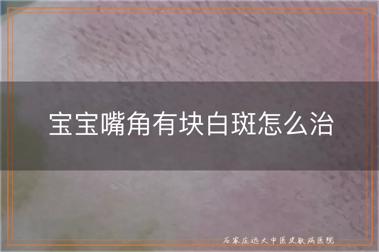 宝宝嘴角有块白斑怎么治