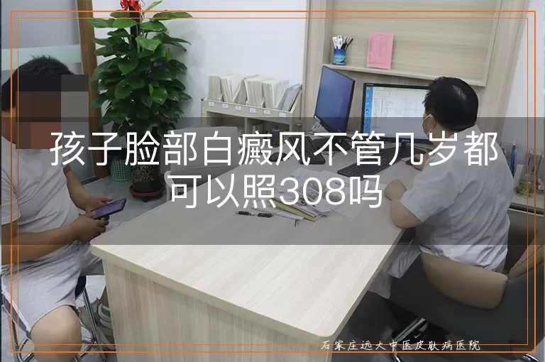 孩子脸部白癜风不管几岁都可以照308吗