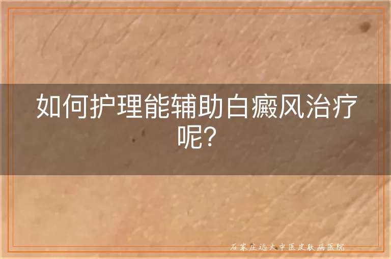 如何护理能辅助白癜风治疗呢？