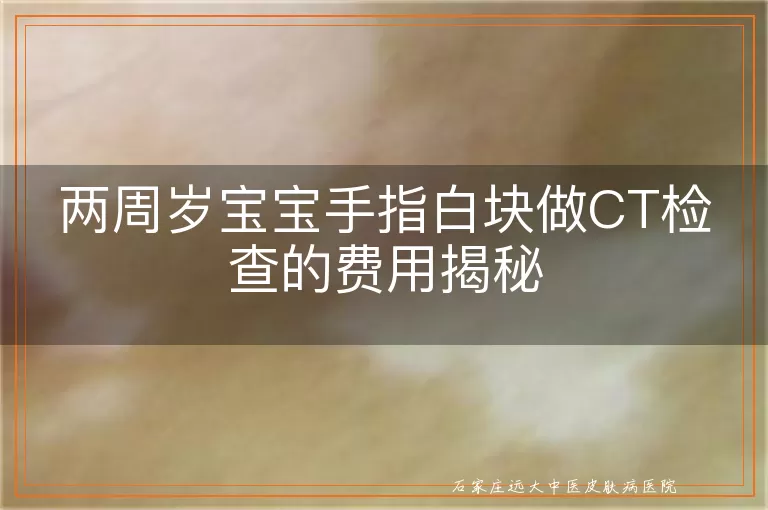 两周岁宝宝手指白块做CT检查的费用揭秘