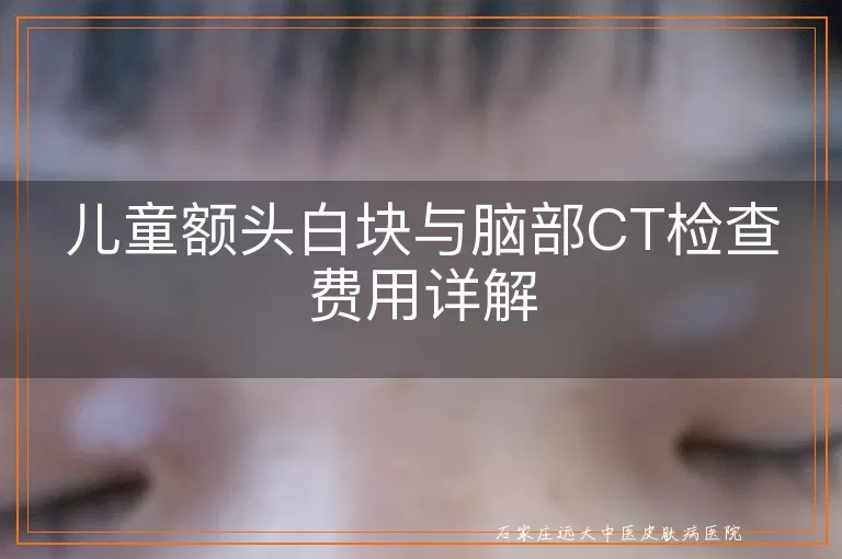 儿童额头白块与脑部CT检查费用详解