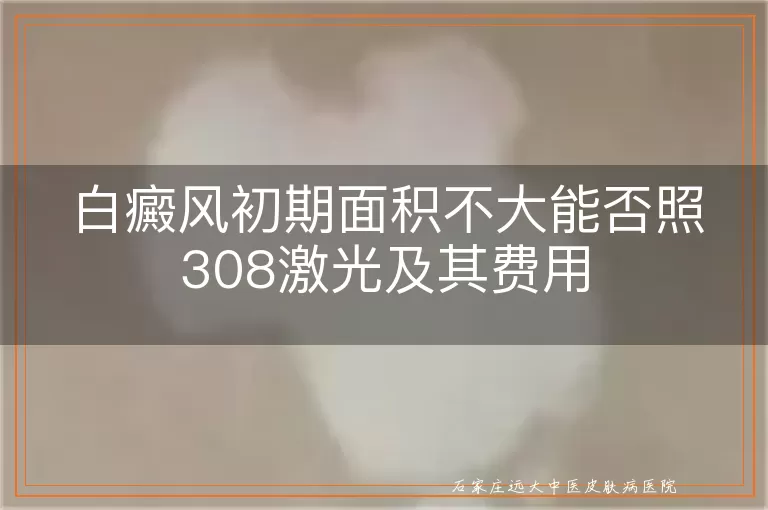 白癜风初期面积不大能否照308激光及其费用
